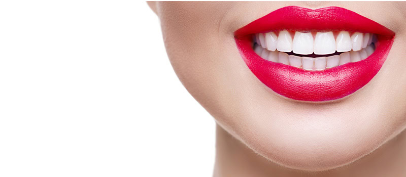 Zoom Teeth Whitening in Waterloo SE1 | Instant Laser ...