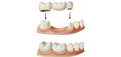 Image module