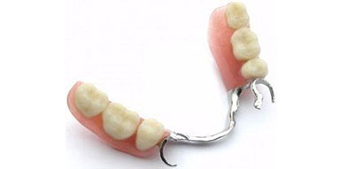 Chrome Metal Denture | Whites Dental