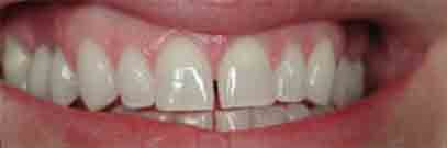 Image module