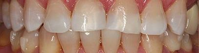 compister before | Whites Dental