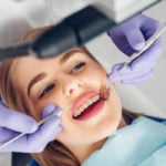 Dental Crowns | Whites Dental
