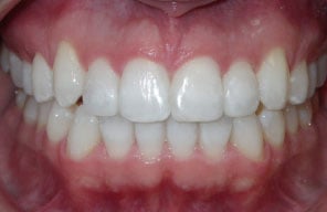 Orthodontist in London Waterloo | Whites Dental