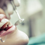 Dental Treatments | Whites Dental