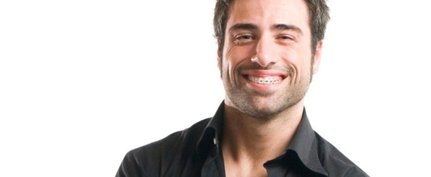 Are Braces Unattractive On Guys