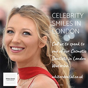 Cosmetic Dentist Teeth Whitening in London Waterloo