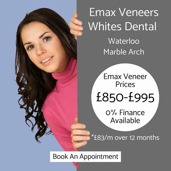 Emax Veneer Price - Whites Dental London