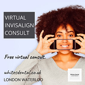 cosmetic dentist veneers london waterloo A | Whites Dental