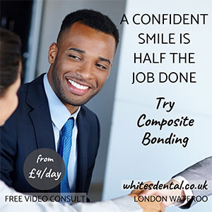 cosmetic dentist veneers london waterloo E | Whites Dental