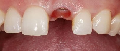 Dental Issue | Whites Dental