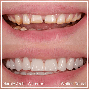Orthodontist In London Waterloo