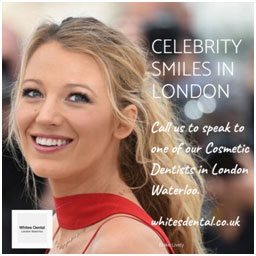 Orthodontic braces London | Whites Dental