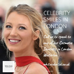 Orthodontist London Waterloo | Whites Dental