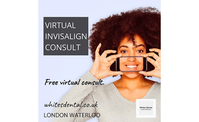 Orthodontist In London Waterloo | Whites Dental