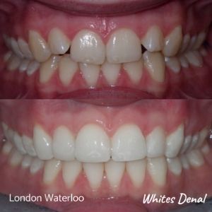 5 star reviews orthodontist cosmetic dentist in london | Whites Dental