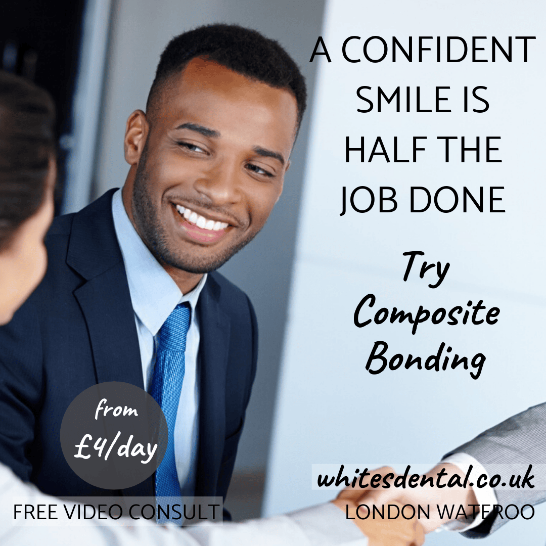 Home Teeth Whitening in London Waterloo. Whites Dental in London