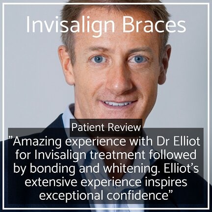 Invisalign Braces Whites Dental in London Waterloo 1