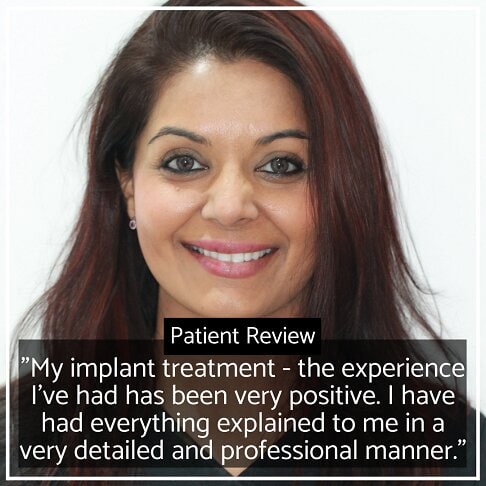 Dental Implant London Review | Whites Dental