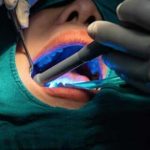 Invisalign in London | Whites Dental