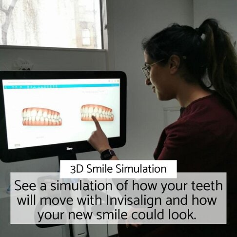 how long does invisalign take | Whites Dental