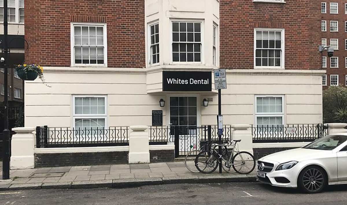 Whites Dental London Marble Arch | Whites Dental