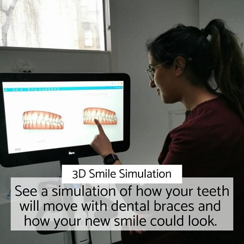 Dr Kiren showing fixed braces simulation to our London patient