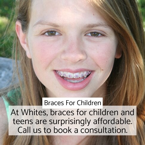 Fixed braces for children in London