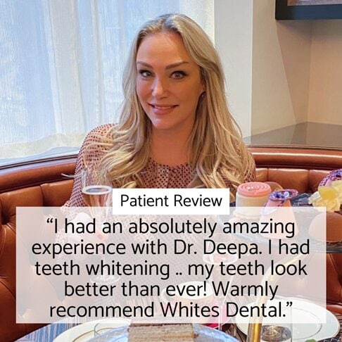 Home whitening London - patient testimonial for home whitening with Dr Deepa