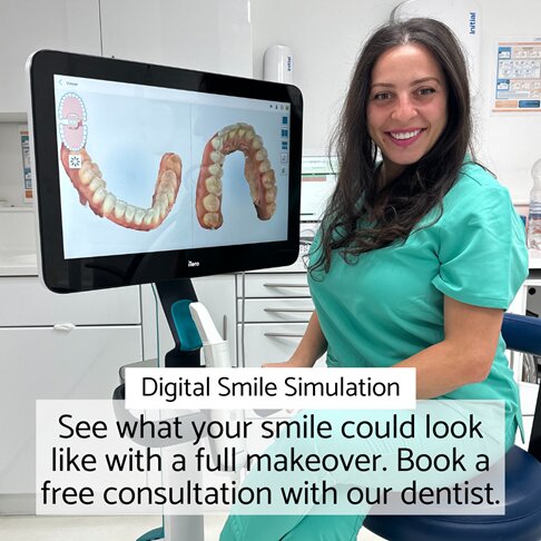 smile simulation with whites dental, straightening, veneers, whitening