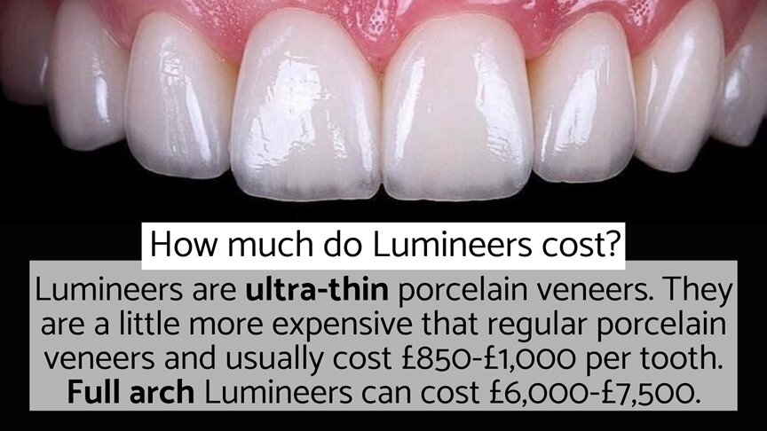 How much do Lumineers cost