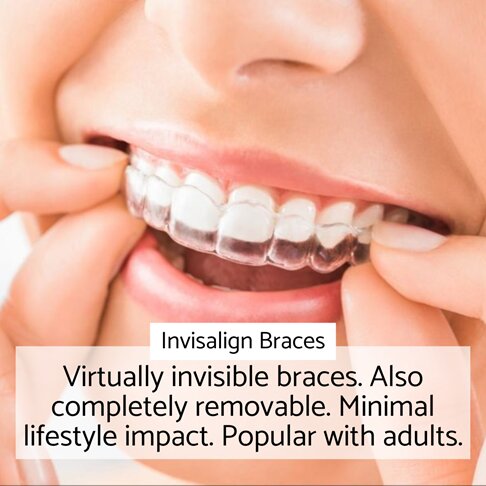 Invisalign