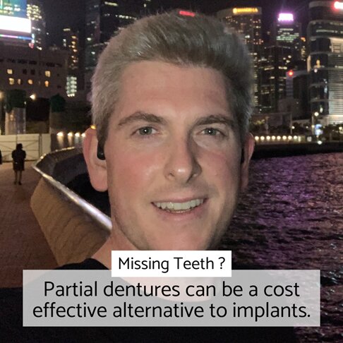 Partial Dentures London - cost effective alternative to implants