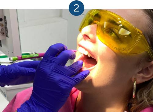 Ceramic braces - brace fitting