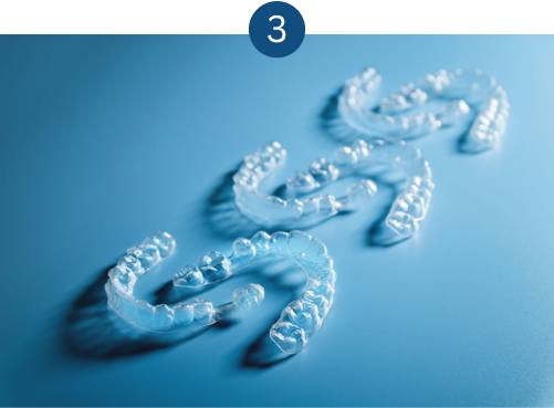 Invisalign journey - wear your aligners