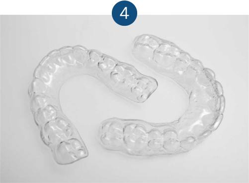 Metal braces - retainer fitting & long-term care