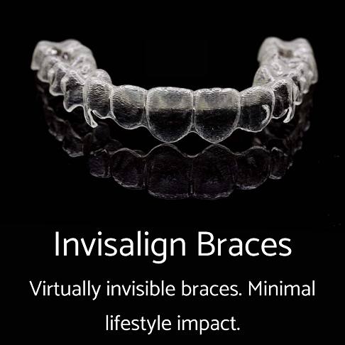 Cosmetic Dentist in London - Invisalign braces