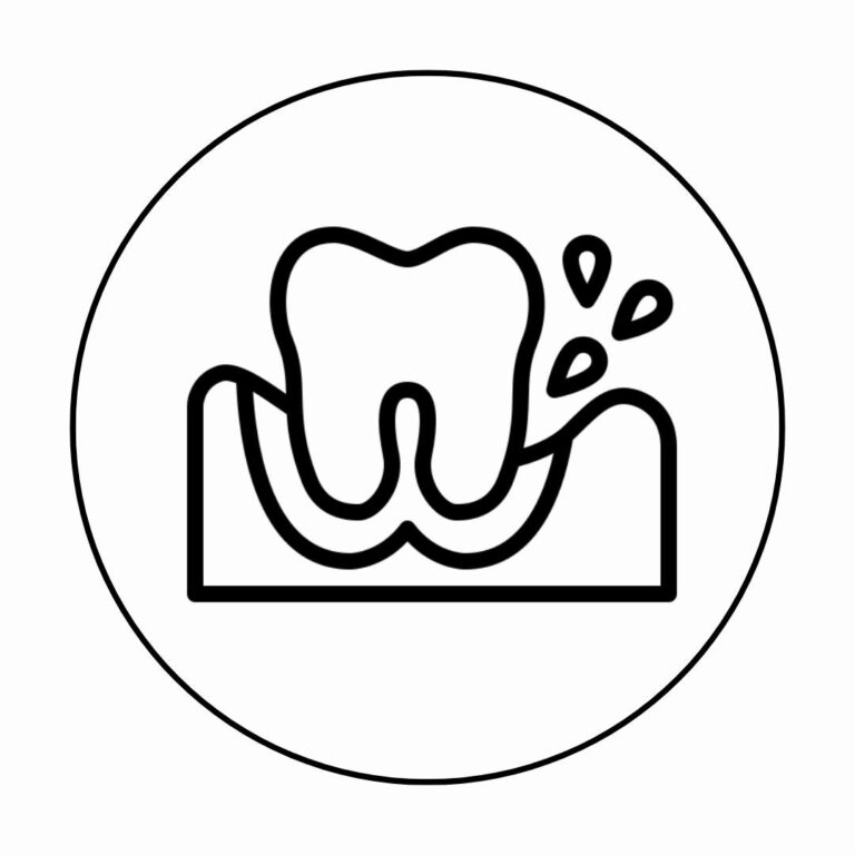 Emergency Dentist - abscess