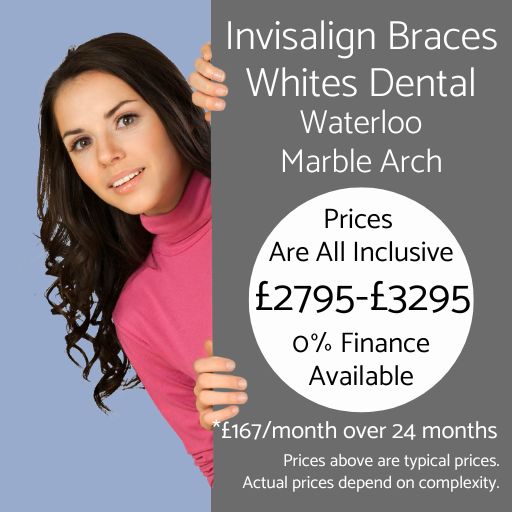 Invisalign Braces Prices - Whites Dental London