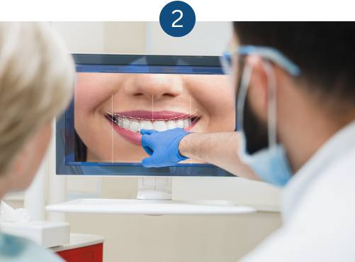 Patient undergoing a trial smile design with porcelain veneers in London