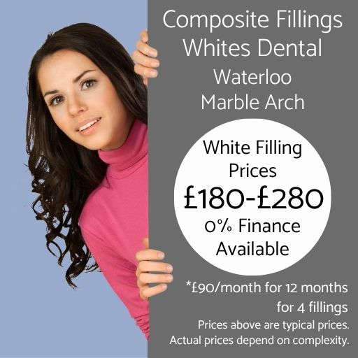 Composite White Fillings Cost - Whites Dental London