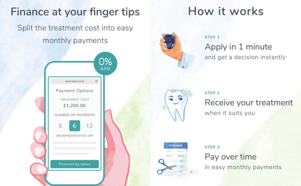 Dental Finance Root Canal Treatment London