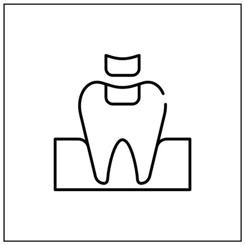 Emergency Dentist London - Broken Filling