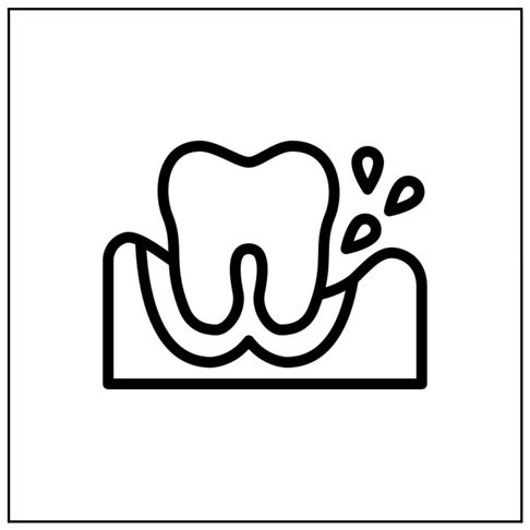 Emergency Dentist London - Tooth Swelling