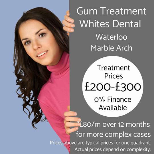 Periodontal treatment for gum disease cost - Whites Dental London