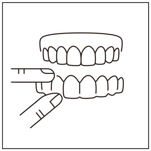 Invisalign Waterloo SE1 - Near London Bridge