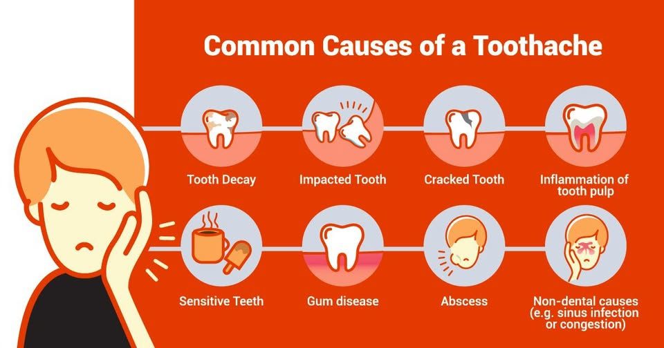 Dental causes of toothache