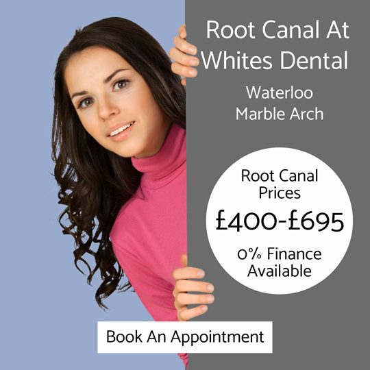 Root Canal London - Book An Appointment