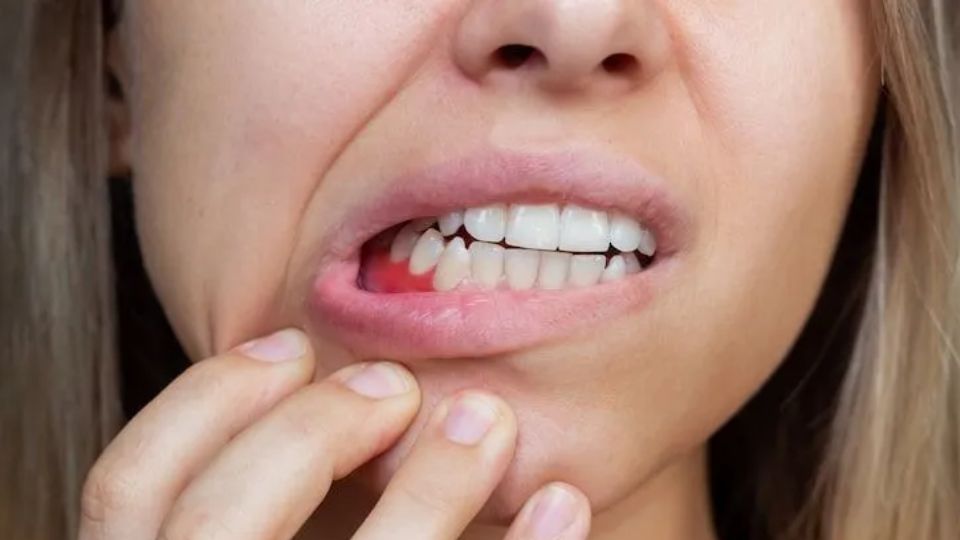 Periodontal treatment in young adult