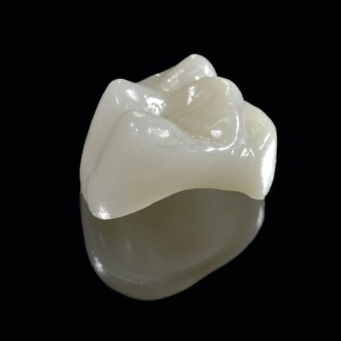 Zirconia crown - whites dental London