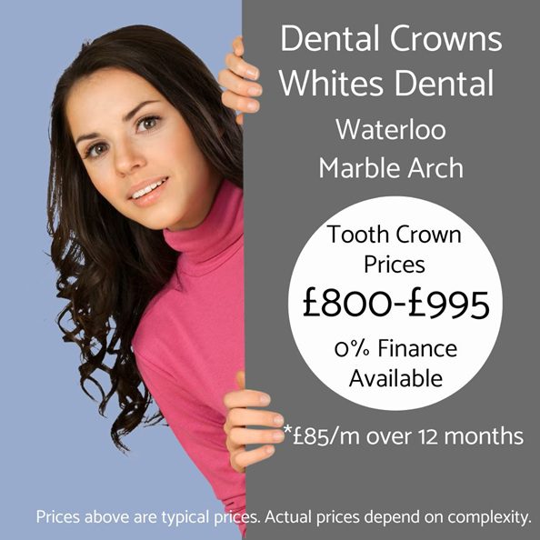 Dental Crown Price - Whites Dental London